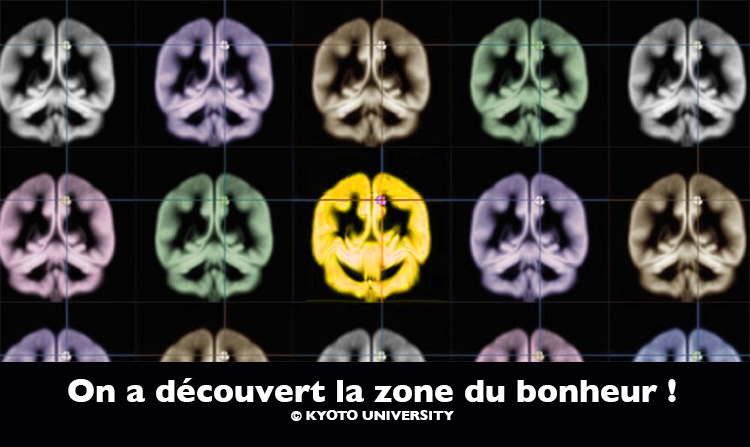 Escaliers vers la Lumière